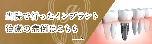 インプラント治療の症例はこちら